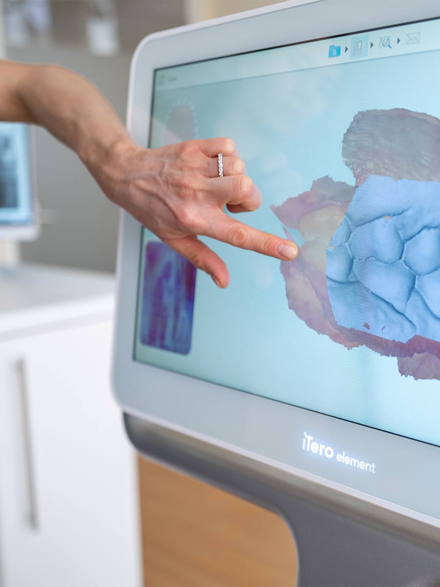 behandlunsgangebote itero scanner kieferortopaede ettlingen