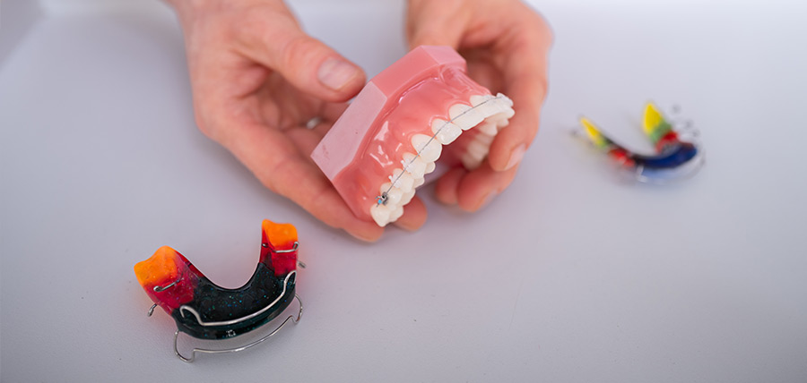 kieferorthopaede kinder jugendliche spangensysteme kfo ettlingen